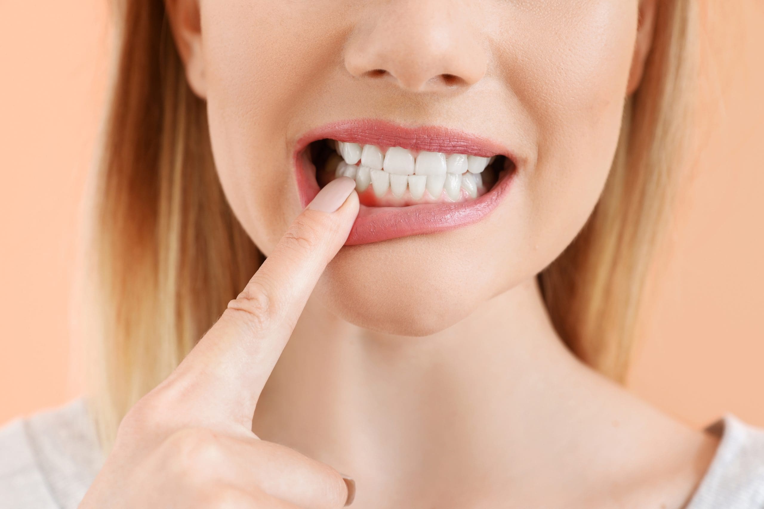 Monrovia Periodontal Gum Disease