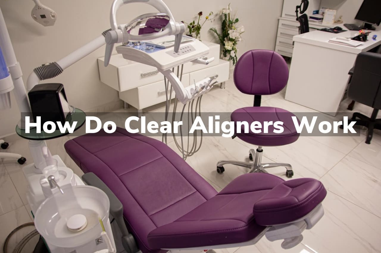 How Do Clear Aligners Work?